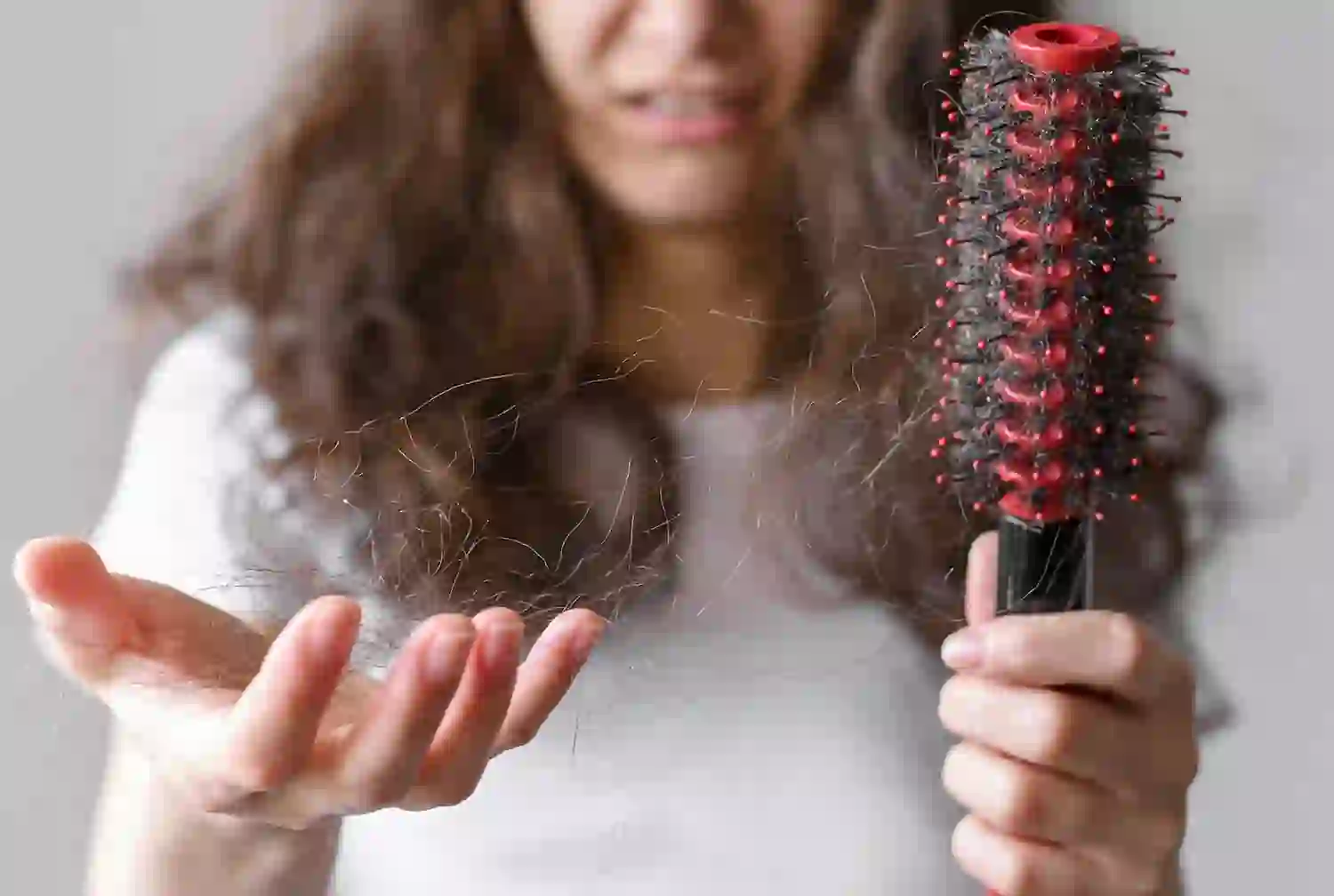 Hair Fall